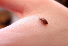 Photo of طرق القضاء على البق نهائيا | افضل 5 مبيدات حشرية للقضاء على حشرة الفراش