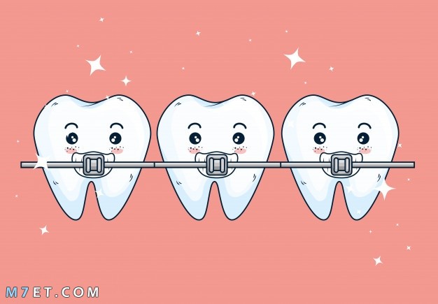 مراحل تقويم الأسنان