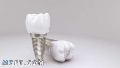 Photo of مراحل زراعة الأسنان هل هي بسيطة أم غير ذلك؟