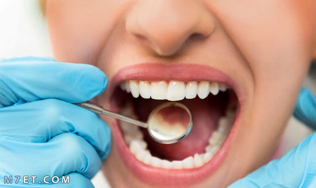 حماية الاسنان من التسوس
