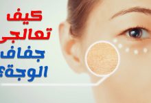 Photo of علاج جفاف الوجه بالأعشاب الطبيعية وأشهر كريمين لعلاج الجفاف من الصيدلية