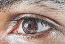Photo of اسباب تجاعيد تحت العين وطرق العلاج بـ 4 وصفات طبيعية