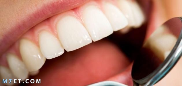 طرق ازالة تسوس الاسنان