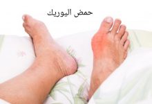 Photo of اسباب ارتفاع حمض اليوريك وأشهر 6 أعشاب طبيعية لعلاجه