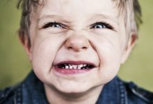 Photo of الجزّ على الأسنان عند الطفل| صك الأسنان