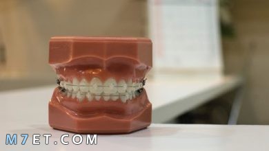 Photo of تقويم الأسنان | فوائد واستخدامات