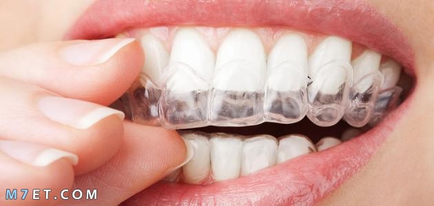 طريقة لتبييض الاسنان في يوم واحد
