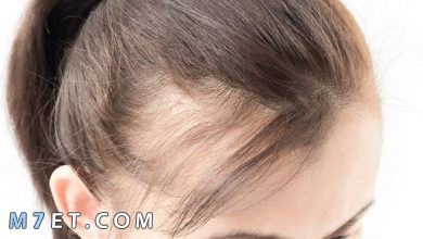 Photo of علاج تساقط الشعر عند النساء بـ 4 طرق طبيعية