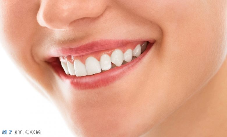 فوائد وأضرار تبييض الأسنان