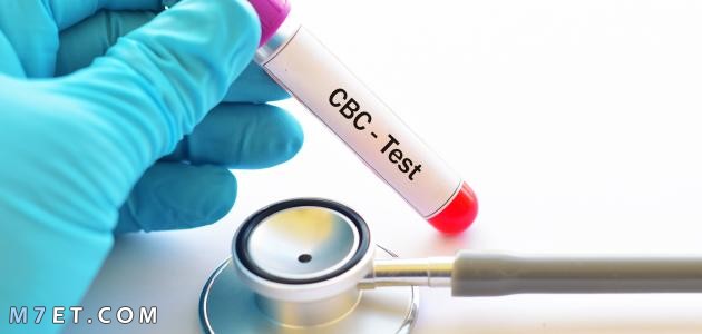 تحليل cbc يكشف الايدز