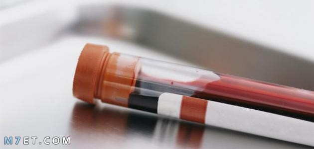 هل تحليل الدم يفطر ؟