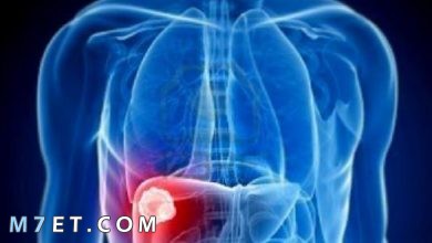 Photo of دهون الكبد | ما هي أعراضها وكيفية العلاج منها وعوامل خطر الإصابة بها