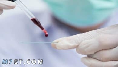 Photo of سعر تحليل الدم الشامل في معمل البرج واسعار التحاليل الاخرى