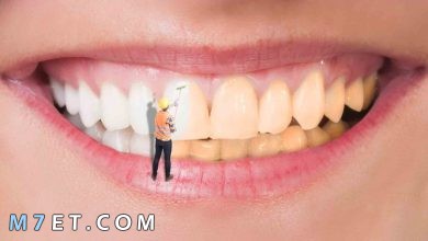 Photo of عروض تنظيف الاسنان