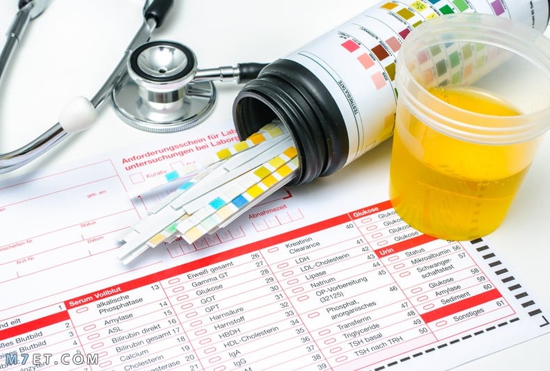 معنى pus cells في تحليل البول