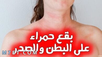 Photo of أسباب ظهور بقع حمراء على البطن والصدر بدون حكة